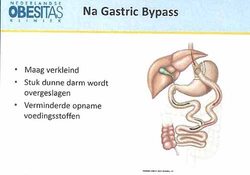 ritaplaatjemaagverkleining02